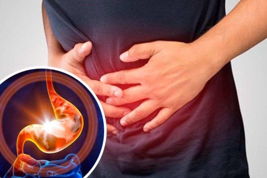 Gastritis
